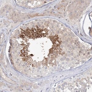 Merck Anti-ADAMTS12 antibody produced in rabbit