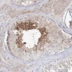 Merck Anti-ADAMTS12 antibody produced in rabbit