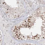 Merck Anti-PTK6 antibody produced in rabbit