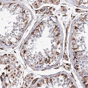 Merck Anti-ALG1L antibody produced in rabbit