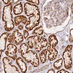 Merck Anti-UMPS antibody produced in rabbit