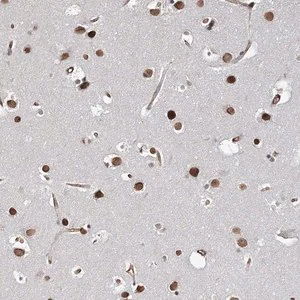 Merck Anti-ATP11B antibody produced in rabbit