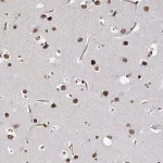 Merck Anti-ATP11B antibody produced in rabbit