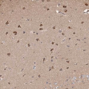 Merck Anti-PLCH1 antibody produced in rabbit