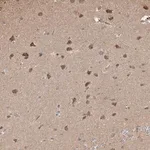 Merck Anti-PLCH1 antibody produced in rabbit