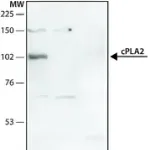 Merck Anti-Phospholipase A2 (CPLA2) antibody produced in rabbit