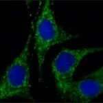 Merck Anti-Rab18 (C-terminal) antibody produced in rabbit