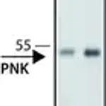 Merck Anti-PNK antibody ,Mouse monoclonal