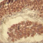 Merck Anti-Rictor antibody produced in rabbit