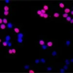 Merck Anti-HOXA3 antibody produced in rabbit