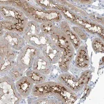 Merck Anti-TNN antibody produced in rabbit