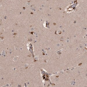 Merck Anti-CYP1B1 antibody produced in rabbit