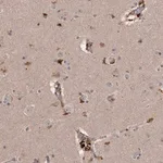 Merck Anti-CYP1B1 antibody produced in rabbit