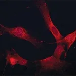 Merck Anti-Coronin 1B antibody produced in rabbit