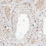 Merck Anti-NHSL1 antibody produced in rabbit