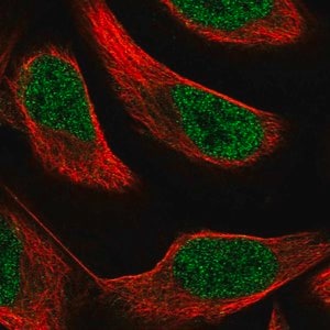 Merck Anti-PAX8 antibody produced in rabbit