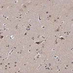 Merck Anti-KLHDC3 antibody produced in rabbit