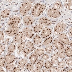 Merck Anti-RFC3 antibody produced in rabbit