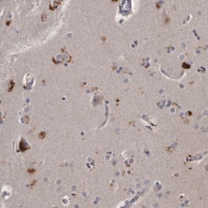 Merck Anti-KLHDC3 antibody produced in rabbit