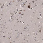 Merck Anti-KLHDC3 antibody produced in rabbit