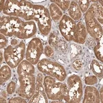 Merck Anti-MTO1 antibody produced in rabbit