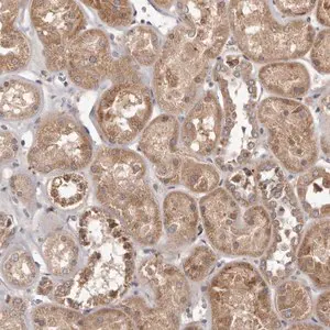 Merck Anti-MTO1 antibody produced in rabbit