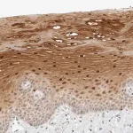 Merck Anti-RIMKLA antibody produced in rabbit