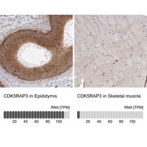 Merck Anti-CDK5RAP3 antibody produced in rabbit