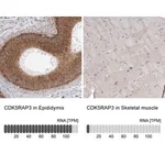 Merck Anti-CDK5RAP3 antibody produced in rabbit