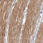 Merck Anti-ZCCHC11 antibody produced in rabbit