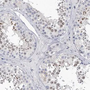 Merck Anti-C2orf83 antibody produced in rabbit
