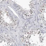 Merck Anti-C2orf83 antibody produced in rabbit