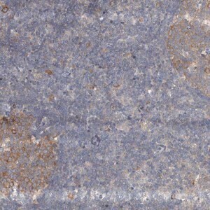 Merck Anti-AKNAD1 antibody produced in rabbit