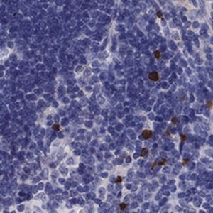 Merck Anti-FRMD1 antibody produced in rabbit