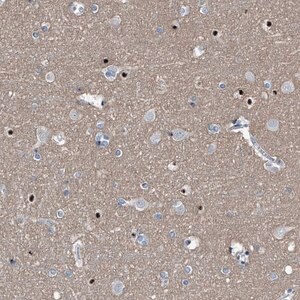 Merck Anti-MEN1 antibody produced in rabbit