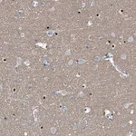 Merck Anti-MEN1 antibody produced in rabbit