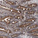 Merck Anti-DLGAP2 antibody produced in rabbit