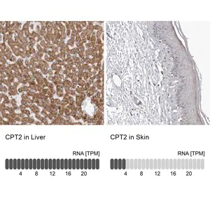 Merck Anti-CPT2 antibody produced in rabbit