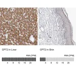 Merck Anti-CPT2 antibody produced in rabbit