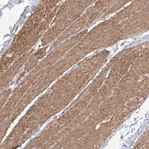 Merck Anti-ZNF180 antibody produced in rabbit