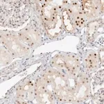 Merck Anti-HIPK3 antibody produced in rabbit