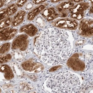 Merck Anti-RAB11FIP3 antibody produced in rabbit