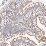 Merck Anti-MYOM3 antibody produced in rabbit