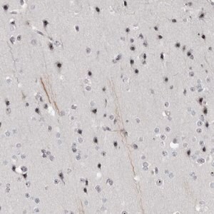 Merck Anti-HELZ antibody produced in rabbit