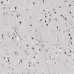 Merck Anti-HELZ antibody produced in rabbit