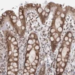 Merck Anti-RASGEF1C antibody produced in rabbit