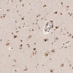 Merck Anti-GLTSCR1L antibody produced in rabbit