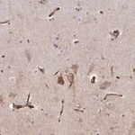 Merck Anti-SEMA3E antibody produced in rabbit