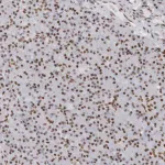 Merck Anti-HP1BP3 antibody produced in rabbit