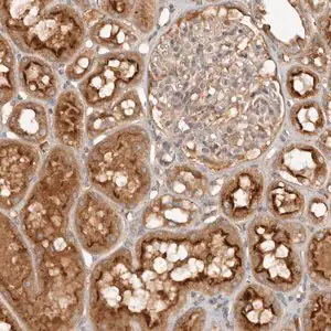 Merck Anti-PKIB antibody produced in rabbit